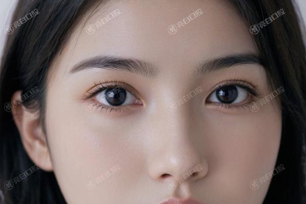 成都弹力线提升便宜又好的整形医院 上榜的口碑也不错