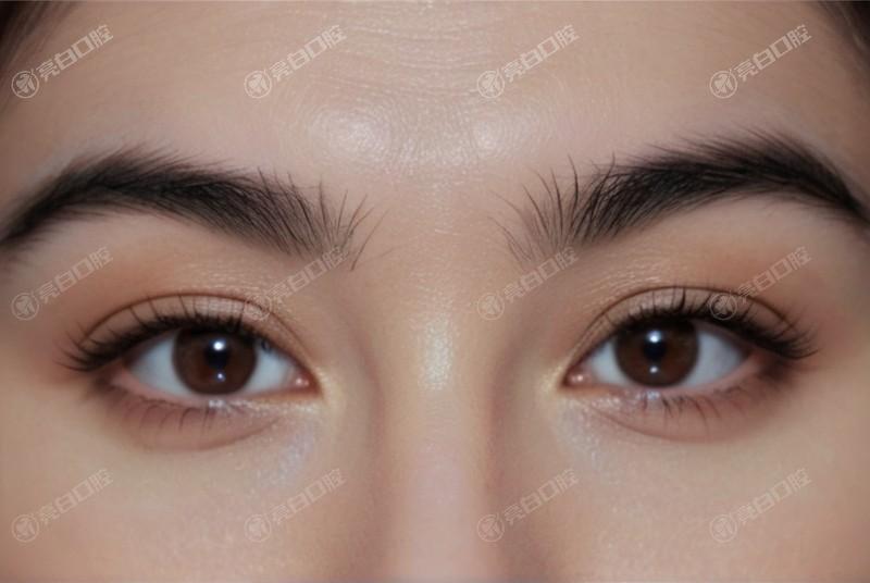 广州佰视佳眼科值得去吗？结合医院地址和热门项目评估其综合水平