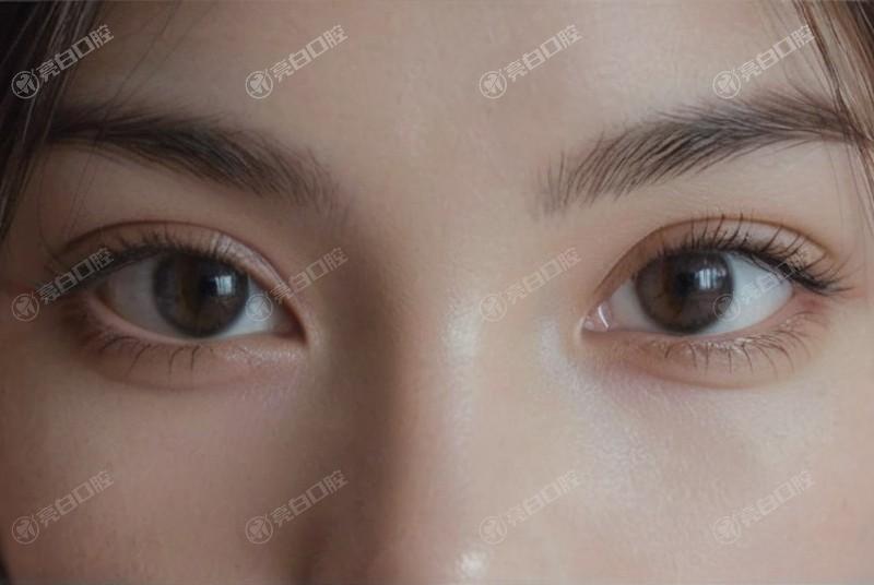 用吸管喝冷饮？牙齿敏感的 “隐形诱因”​