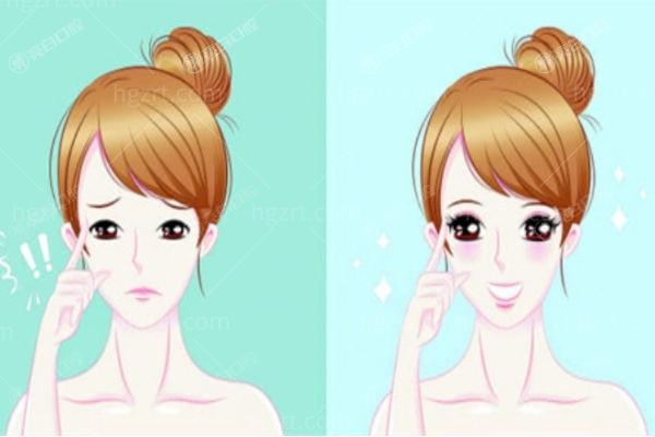 邢台伊美整形医院靠谱吗？资质信息+热门项目，口碑评价深度分析了解！